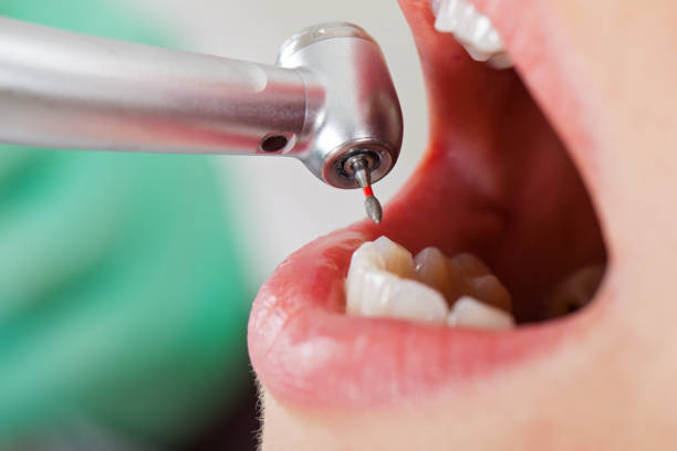 Best Emergency Dentist for Knocked-Out Tooth in Johnson, AR